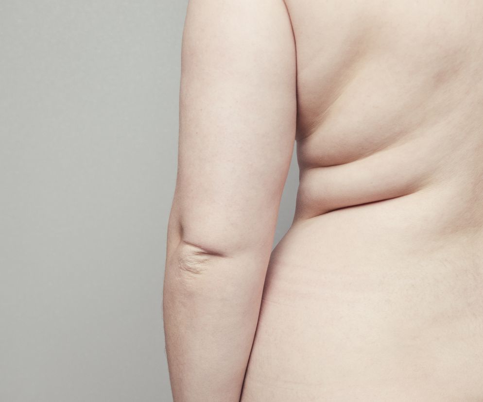 Masz fałdki pod pachami i na plecach? Musisz wypróbować te ćwiczenia