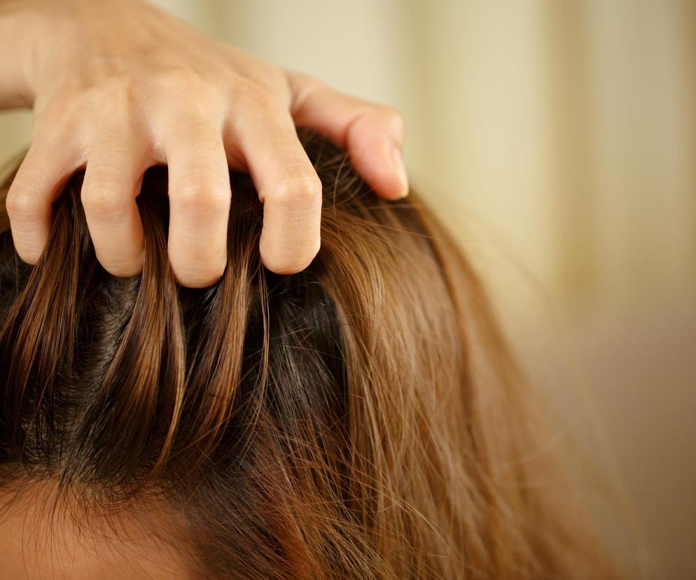 Cola na... włosy? Moda z Instagrama może być bardzo szkodliwa