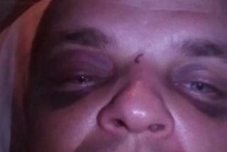 Pobili mnie sołtys i jego brat 