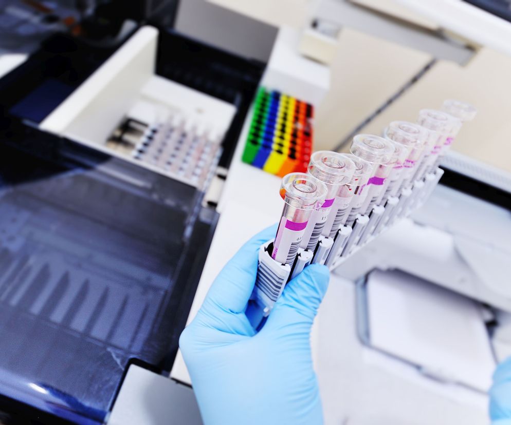 Przewlekła białaczka limfocytowa to nowotwór krwi, który można zdiagnozować wyłącznie metodą cytometrii przepływową.