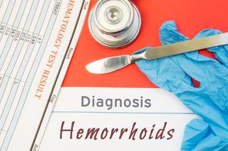 Leczenie hemoroidów. Jak skutecznie wyleczyć hemoroidy?