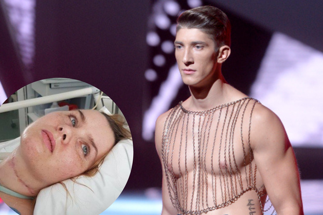 Michał Baryza z Top Model ratuje zdrowie niepełnosprawnej Mariki. Ledwo uszła z życiem