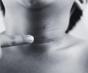 Ten gadżet na insekty ma w domu wielu z nas. 5-latek omal się na nim nie powiesił 