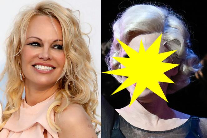  Pamela Anderson ma nową twarz? Szósty rozwód jej posłużył