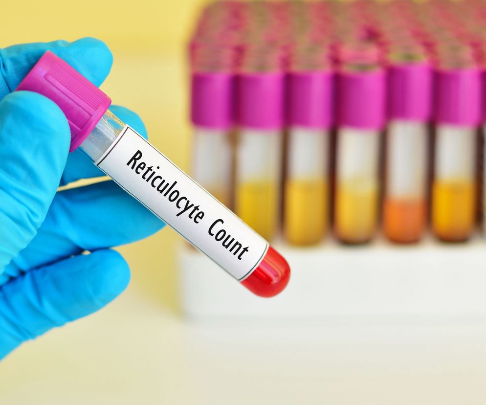 Retikulocyty: norma, zbyt niskie i zbyt wysokie