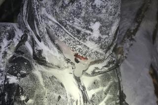 Twarz pokryta lodem, temperatura ciała zaledwie 32 stopnie! Turyście groziło zamarznięcie