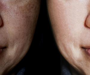  Domowa maseczka na przebarwienia, zmarszczki, naczynka. Wszystkie składniki znajdziesz w kuchni