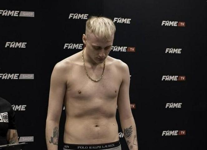 Tak wygląda twarz Tomka Olejnika po FAME 20. Żołądek podchodzi do gardła, ohydny widok