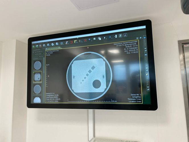 Oddział wewnętrzny oraz oddział otolaryngologii i onkologii laryngologicznej w siedleckim szpitalu wojewódzkim już otwarte