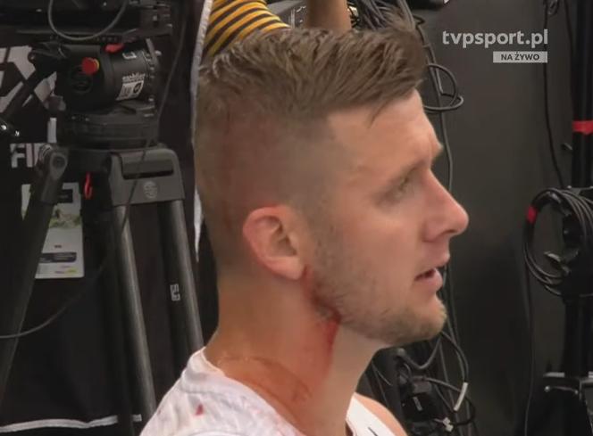 MŚ w koszykówce 3x3: Przemysław Zamojski trafiony łokciem
