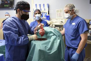 Lekarze wszczepili mu serce świni! ‌Wielki przełom w medycynie