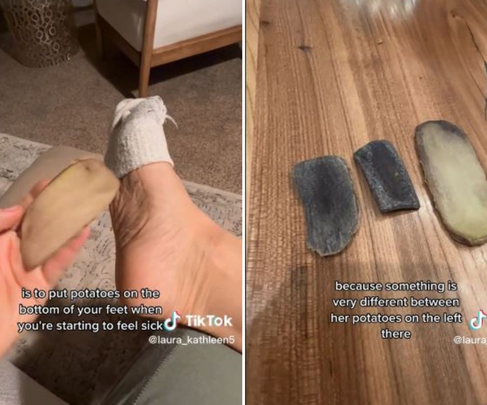 Ziemniak w skarpecie wyleczy przeziębienie? Lekarka wyjaśnia, czy to działa