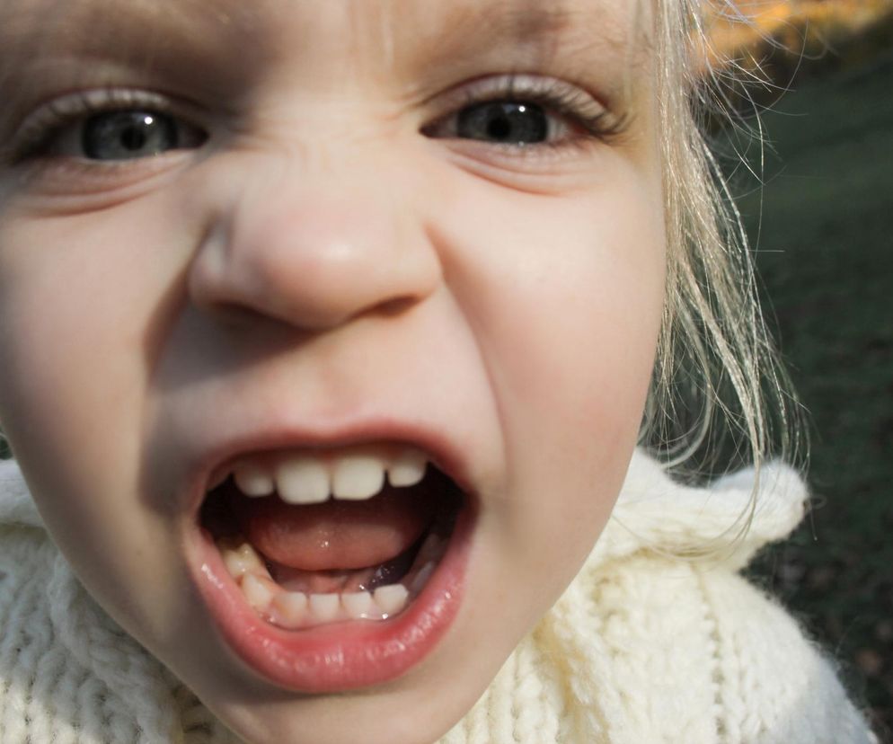 Próchnica mleczaków to nie tylko problem estetyki. Tak wpływa na odporność 