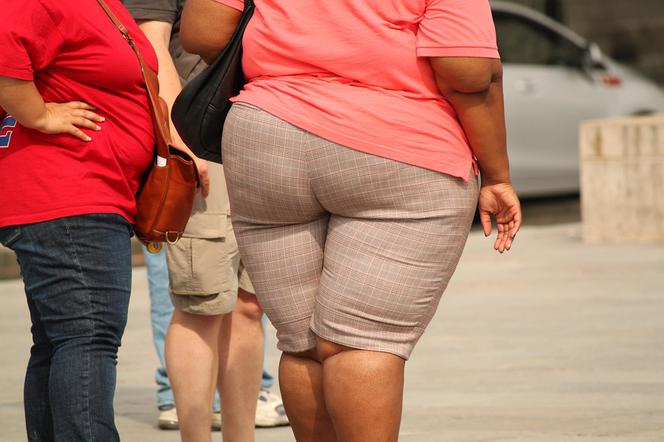 Dobre wieści dla otyłych: W Rzeszowie w ramach NFZ będą operacyjnie zmniejszać żołądki