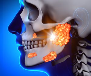Ślinianki (gruczoły ślinowe): budowa, rola, choroby