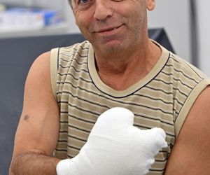 W 5 Klinicznym Szpitalu Wojskowym  Krakowie przyszyli panu Markowi kciuk