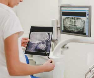 Żuchwa - budowa, funkcje, choroby