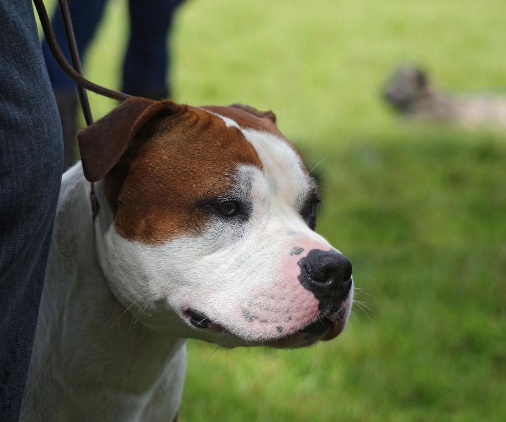 Agresywny amstaff dotkliwie pogryzł kobietę!