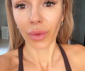 Doda pokazała bliznę po wycięciu czerniaka