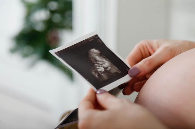  Co oznaczają skróty w wyniku badania USG ciąży?