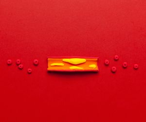 Blaszka miażdżycowa – jak powstaje?