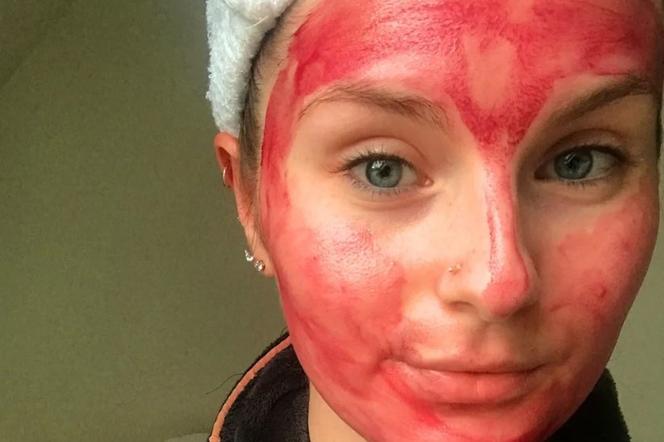 Trend na TikToku. Kobiety smarują twarz krwią menstruacyjną