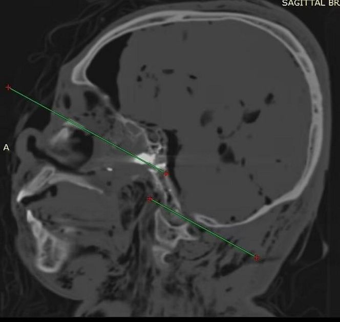Ujawnił prawdę o sztucznej inteligencji. Znaleziono go martwego