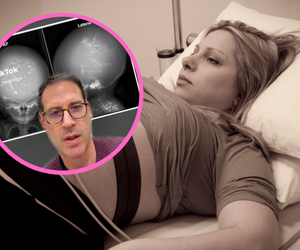 Badanie USG ujawniło coś niebywałego w głowie dziecka. Nawet lekarze byli w szoku