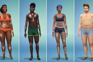 Bielactwo w The Sims 4 - zobacz, jak wyglądają simowie z nową cechą wyglądu