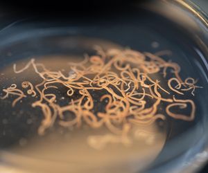 Ten pasożyt opanował polskie piaskownice i place zabaw. Zarażenie może nawet zagrozić życiu