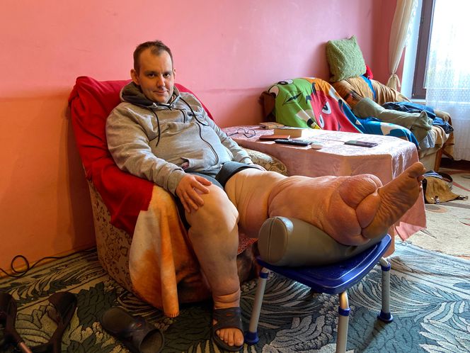 Paweł Kitlas (39 l.) z Białegostoku cierpi na tajemniczą chorobę. Lekarze w Polsce nie potrafią mu pomóc