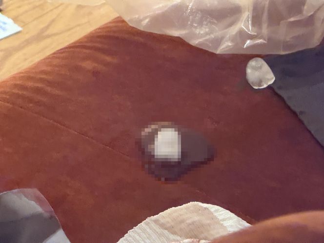 Atak nożownika w hotelu