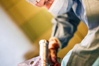 Dostał łapę z drukarki 3d