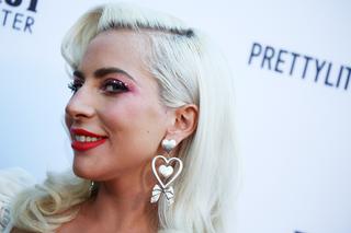 Lady Gaga zrobiła rentgen całego ciała! To efekt upadku ze sceny