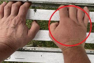 Paweł Kukiz ucierpiał. Pokazał opuchniętą dłoń