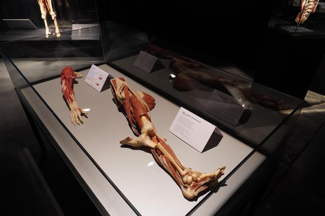 Wystawa z ludzkiego ciała. Body Worlds powróciła do Gdańska po 5 latach 