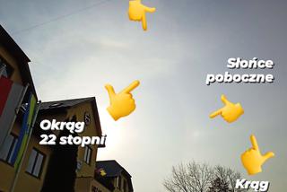 Łuk okołozenitalny