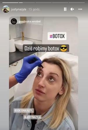 Justyna Żyła ingerowała w swój wygląd