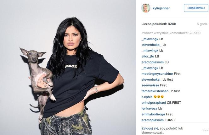 Kylie Jenner powiększyła usta?