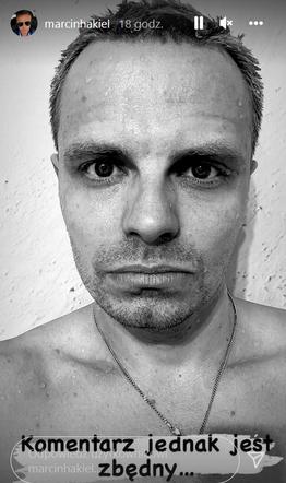 Hakiel na terapii po rozstaniu z Cichopek