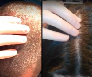 Przestał używać szamponu 7 lat temu. Pokazał, jak dziś wyglądają jego włosy