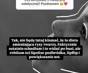 Natalia Zambrzycka (Agata z serialu Barwy szczęścia) na Instagramie przyznała się, co zrobiła z twarzą! 