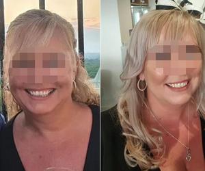 Skusiła ją tania operacja odchudzająca w Turcji. Już nigdy się nie obudziła