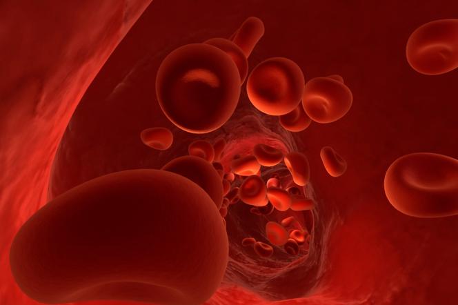 Anemia. Jak się objawia anemia