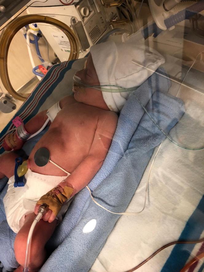 Apel o pomoc dla bliźniaków