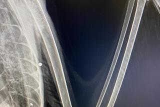 Łabędzica Lusia postrzelona w dziób i skrzydło