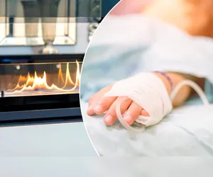 Wybuch ognia w biokominku. 9-letnia dziewczynka w ciężkim stanie 