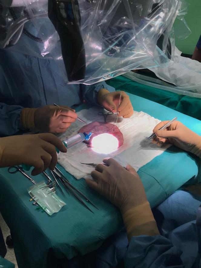 Przyszyli 7-latce skalp. Operacja trwała 7 godzin!