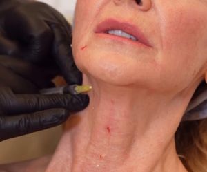 Jenningsowie kontra Alzheimer (BBC Earth)