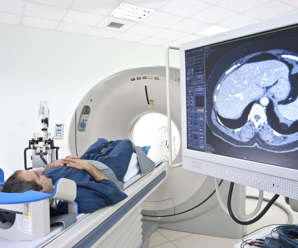 Badanie fMRI, czyli funkcjonalny rezonans magnetyczny. 
 Na czym polega badanie aktywności mózgu?